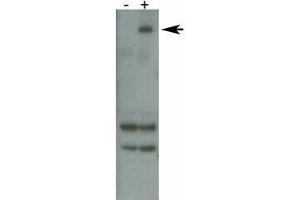 PARK8 / LRRK2 antibody detects over-expressed human LRRK2 protein.