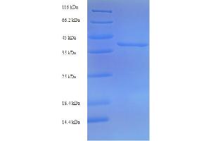 Image no. 1 for Receptor (TNFRSF)-Interacting serine-threonine Kinase 1 (RIPK1) (AA 24-247), (partial) protein (His-SUMO Tag) (ABIN5710918)