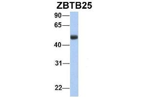 Image no. 3 for anti-Zinc Finger and BTB Domain Containing 25 (ZBTB25) (Middle Region) antibody (ABIN2780821)