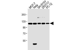 Image no. 4 for anti-Insulin Receptor (INSR) (AA 27-57), (N-Term) antibody (ABIN392004)