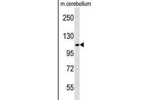 MBD6 antibody  (C-Term)