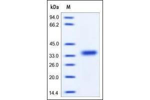 Image no. 1 for Coxsackie Virus and Adenovirus Receptor (CXADR) (AA 20-237) protein (His tag) (ABIN2180951)