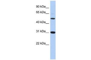 Image no. 1 for anti-Peptidase Inhibitor 16 (PI16) (Middle Region) antibody (ABIN634818)