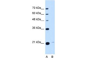 Image no. 1 for anti-Transmembrane Emp24 Protein Transport Domain Containing 3 (TMED3) (C-Term) antibody (ABIN2782763)