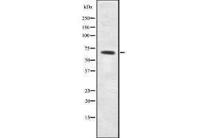 Image no. 1 for anti-NAD Dependent Malate Dehydrogenase (NAD-ME) antibody (ABIN6263183)