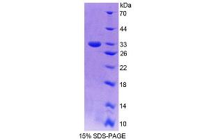Image no. 1 for Guanylate Binding Protein 6 (GBP6) (AA 35-277) protein (T7 tag,His tag) (ABIN6239549)
