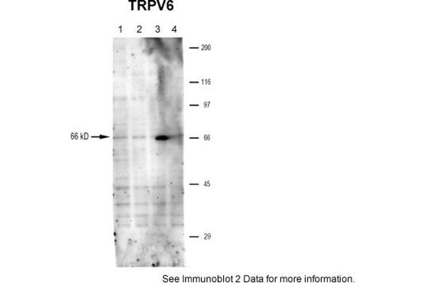 TRPV6 antibody  (Middle Region)