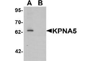Image no. 2 for anti-Karyopherin alpha 5 (Importin alpha 6) (KPNA5) (N-Term) antibody (ABIN1450110)