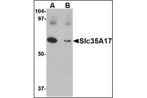 Image no. 2 for anti-Solute Carrier Family 22 (Organic Cation Transporter), Member 17 (SLC22A17) (C-Term) antibody (ABIN500738)