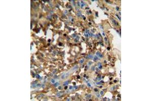 Image no. 1 for anti-Family with Sequence Similarity 20, Member C (FAM20C) (AA 443-471), (C-Term) antibody (ABIN951886)