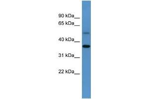Image no. 1 for anti-Glycogenin (GYG) (C-Term) antibody (ABIN2783439)