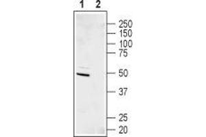 KCNJ11 antibody  (C-Term, Intracellular)