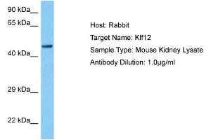 Image no. 4 for anti-Kruppel-Like Factor 4 (Gut) (KLF4) (C-Term) antibody (ABIN2780577)