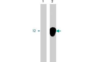 Image no. 1 for anti-TYRO Protein tyrosine Kinase Binding Protein (TYROBP) antibody (ABIN550357)