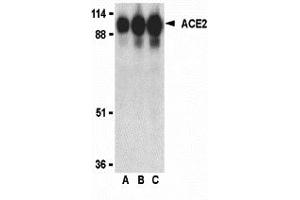 Western Blotting (WB) image for anti-Angiotensin I Converting Enzyme 2 (ACE2) (Middle Region 1) antibody (ABIN1031184)