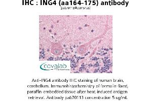 Image no. 1 for anti-Inhibitor of Growth Family, Member 4 (ING4) (AA 164-175) antibody (ABIN1735924)