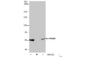 Image no. 4 for anti-phosphoglycerate Dehydrogenase (PHGDH) (N-Term) antibody (ABIN2855237)