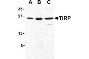 Image no. 2 for anti-Toll-Like Receptor Adaptor Molecule 2 (TICAM2) (C-Term) antibody (ABIN500931)