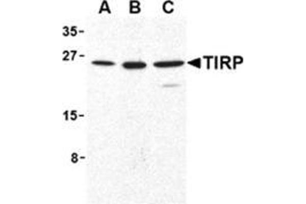 TICAM2 antibody  (C-Term)