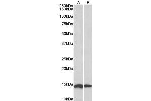 Image no. 2 for anti-NADH Dehydrogenase (Ubiquinone) Fe-S Protein 6, 13kDa (NADH-Coenzyme Q Reductase) (NDUFS6) (Internal Region) antibody (ABIN571094)