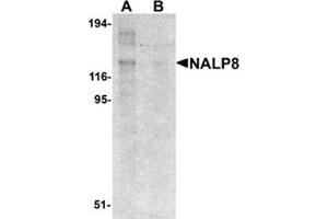 Image no. 1 for anti-NLR Family, Pyrin Domain Containing 8 (NLRP8) (N-Term) antibody (ABIN783713)