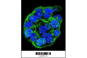 Image no. 2 for anti-Wilms Tumor 1 Interacting Protein (WTIP) (C-Term) antibody (ABIN2494169)