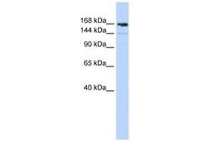 Image no. 1 for anti-Periplakin (PPL) (AA 1044-1093) antibody (ABIN6743088)