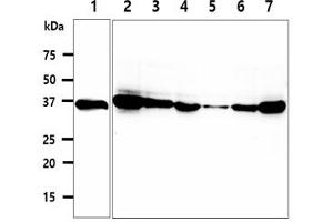 Image no. 1 for anti-Coproporphyrinogen Oxidase (CPOX) antibody (ABIN5776081)