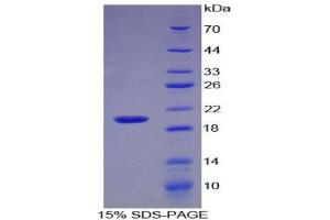 Image no. 1 for Interleukin 17 (IL17) (AA 20-155) protein (His tag) (ABIN1879842)