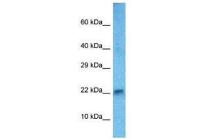 Image no. 1 for anti-Heart and Neural Crest Derivatives Expressed 2 (HAND2) (C-Term) antibody (ABIN2779346)