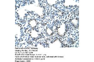 Image no. 4 for anti-Semenogelin I (SEMG1) (N-Term) antibody (ABIN2777136)