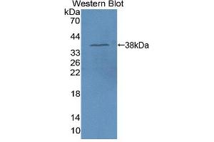 Image no. 1 for anti-3-Hydroxymethyl-3-Methylglutaryl-CoA Lyase (HMGCL) (AA 1-325) antibody (ABIN5013041)