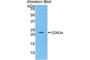 Image no. 1 for anti-Bleomycin Hydrolase (BLMH) (AA 27-164) antibody (ABIN1858141)