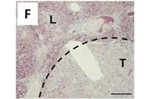 Image no. 6 for anti-Hepatitis B Virus Surface Antigen (HBsAg) antibody (ABIN285516)