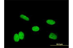 Image no. 3 for anti-Homeobox A11 (HOXA11) (AA 60-166) antibody (ABIN561323)