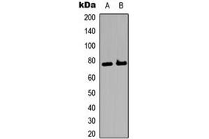 Image no. 2 for anti-BMX Non-Receptor Tyrosine Kinase (BMX) (C-Term) antibody (KLH) (ABIN2972677)