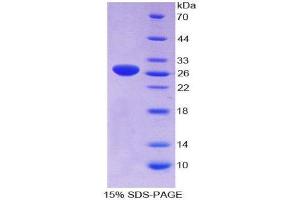 Image no. 1 for Growth Arrest-Specific 6 (GAS6) (AA 100-312) protein (His tag) (ABIN1877629)