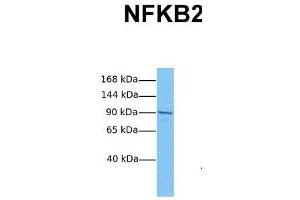 Image no. 5 for anti-Nuclear Factor of kappa Light Polypeptide Gene Enhancer in B-Cells 2 (NFKB2) (C-Term) antibody (ABIN2779436)