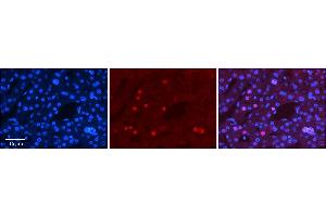 Image no. 2 for anti-Zinc Finger Protein 3 (ZNF3) (N-Term) antibody (ABIN2777975)