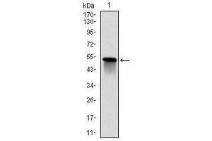Image no. 3 for anti-Glutathione S-Transferase mu 1 (GSTM1) antibody (ABIN1107460)