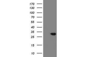 Image no. 4 for anti-Prefoldin Subunit 3 (PFDN3) antibody (ABIN1501705)