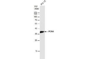 Image no. 7 for anti-Proliferating Cell Nuclear Antigen (PCNA) (Center) antibody (ABIN2854788)
