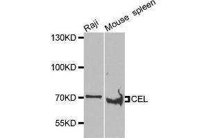 Image no. 1 for anti-Cholesterol Esterase (CEL) antibody (ABIN2736505)