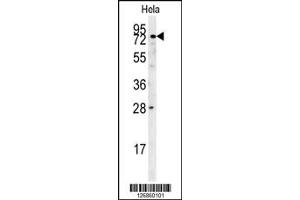 Image no. 1 for anti-Iduronidase, alpha-L- (IDUA) antibody (ABIN2439171)