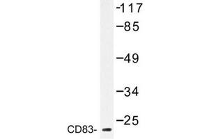 Image no. 1 for anti-CD83 (CD83) antibody (ABIN272283)