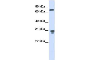 anti-Nitrilase Family, Member 2 (NIT2) (Middle Region) antibody