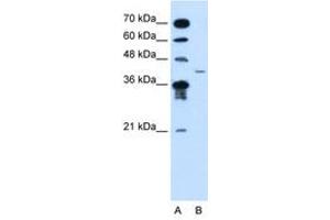 Image no. 1 for anti-Microfibrillar-Associated Protein 3-Like (MFAP3L) (AA 104-153) antibody (ABIN205052)