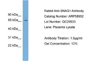 Image no. 2 for anti-Sorting Nexin 18 (SNX18) (C-Term) antibody (ABIN2787890)