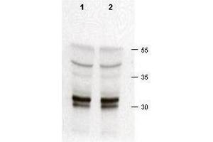 Rabbit anti-cdk2  was used at a 1:200 dilution to detect cdk-2 in asynchronous HeLa cell lysates (run in duplicate).