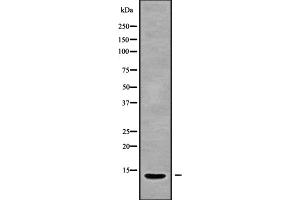 Western blot analysis IGFL2 using 293 whole cell lysates